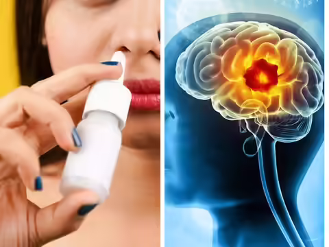 Is it possible?! Researchers invent 'nasal drops' that eliminate head