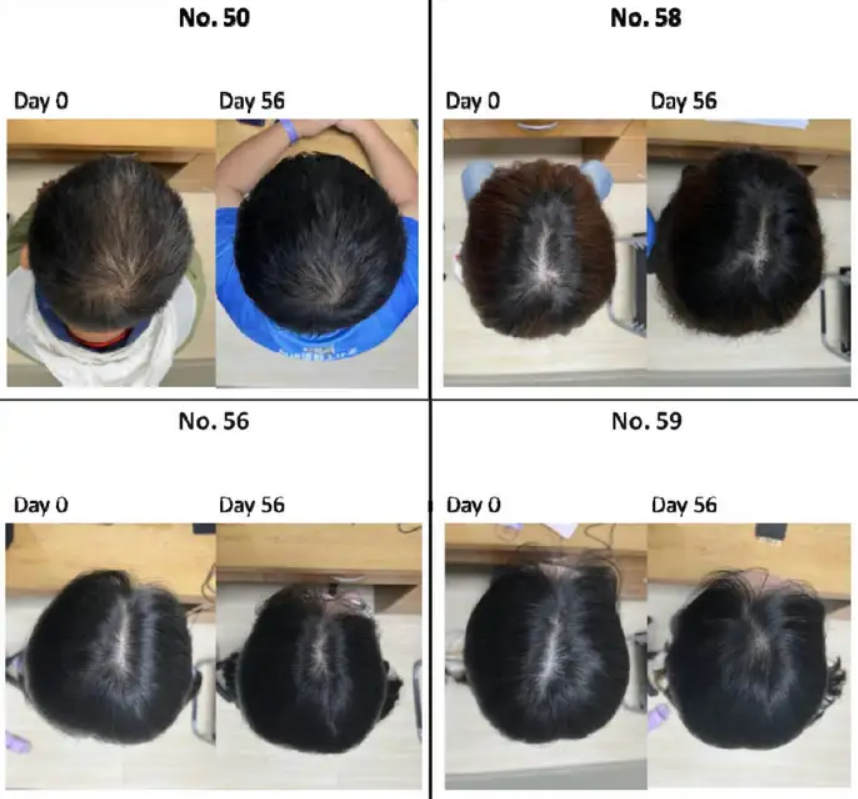 Shkencëtarët testojnë me sukses serumin e bazuar në