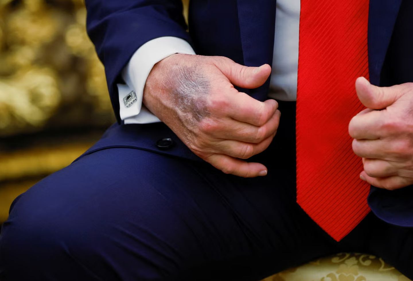 Fotot e dorës së nxirë të Donald Trump, Shtëpia e