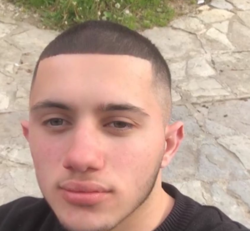 Vdes 18-vjeçari në Kosovë, u godit me veturë dhe u rrah