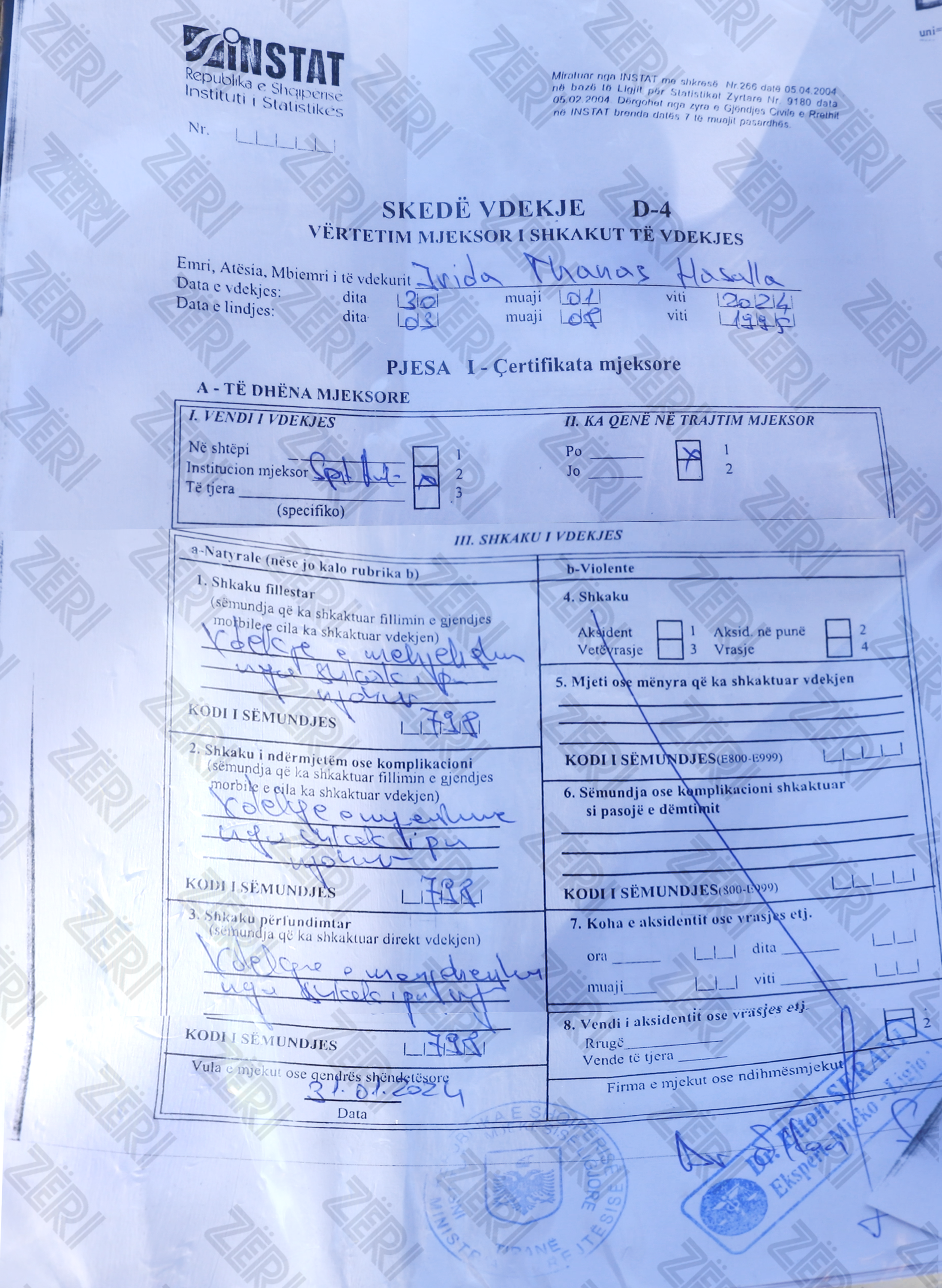 'Vdiq nga tromboza'/ Irida Hasalla humbi jetën pas operacionit te